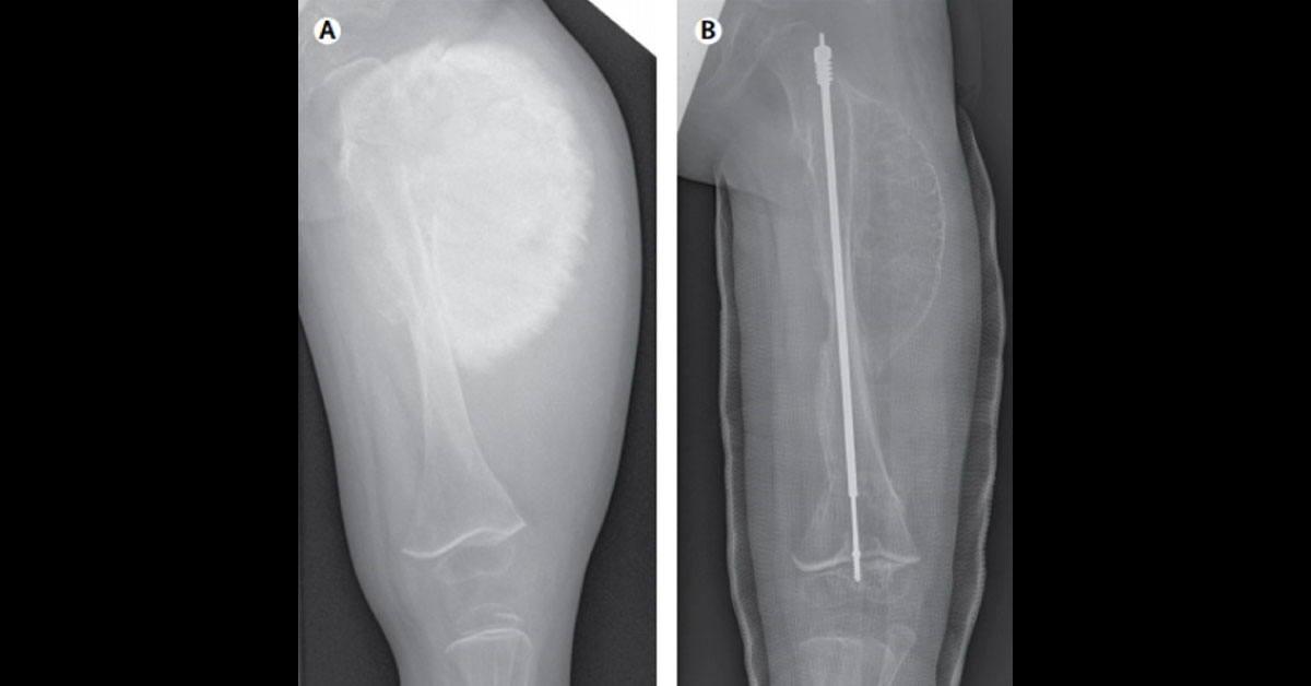 Interpret The Radiograph