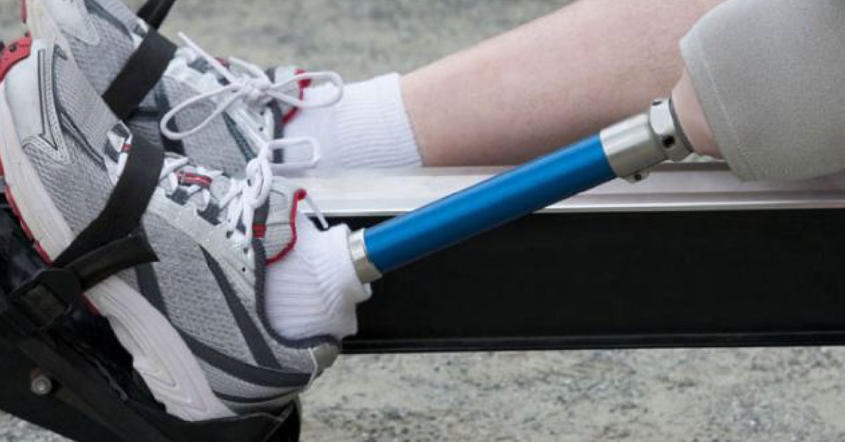New Prosthetic Limbs Following Command From Human Body Developed