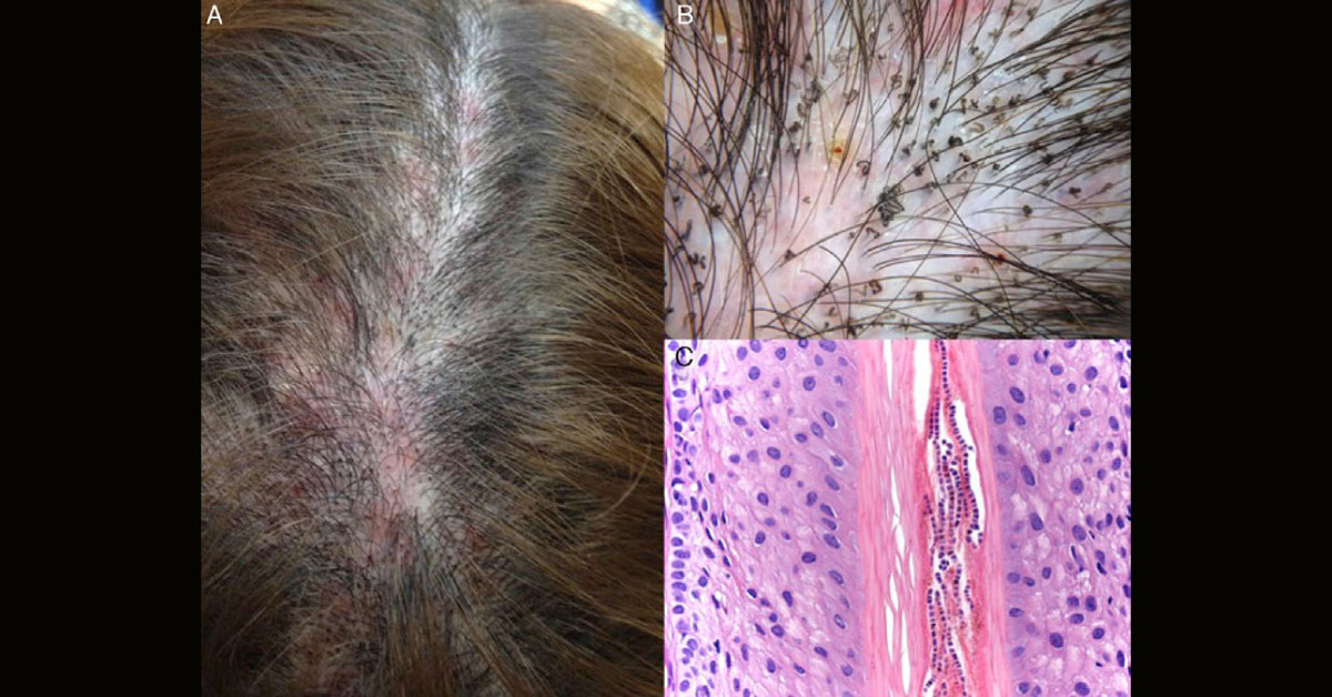 Identify This Dermatological Condition