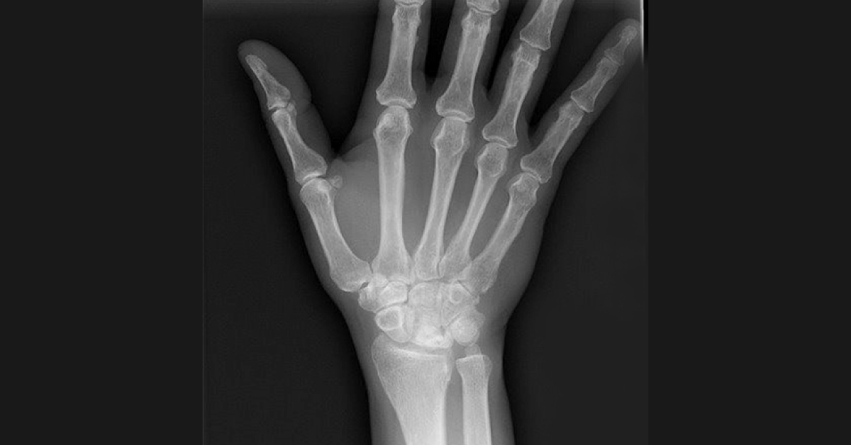 Apply Your Knowledge For This Radiograph