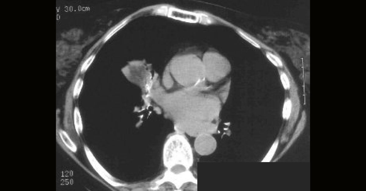 Identify Condition From Radiograph