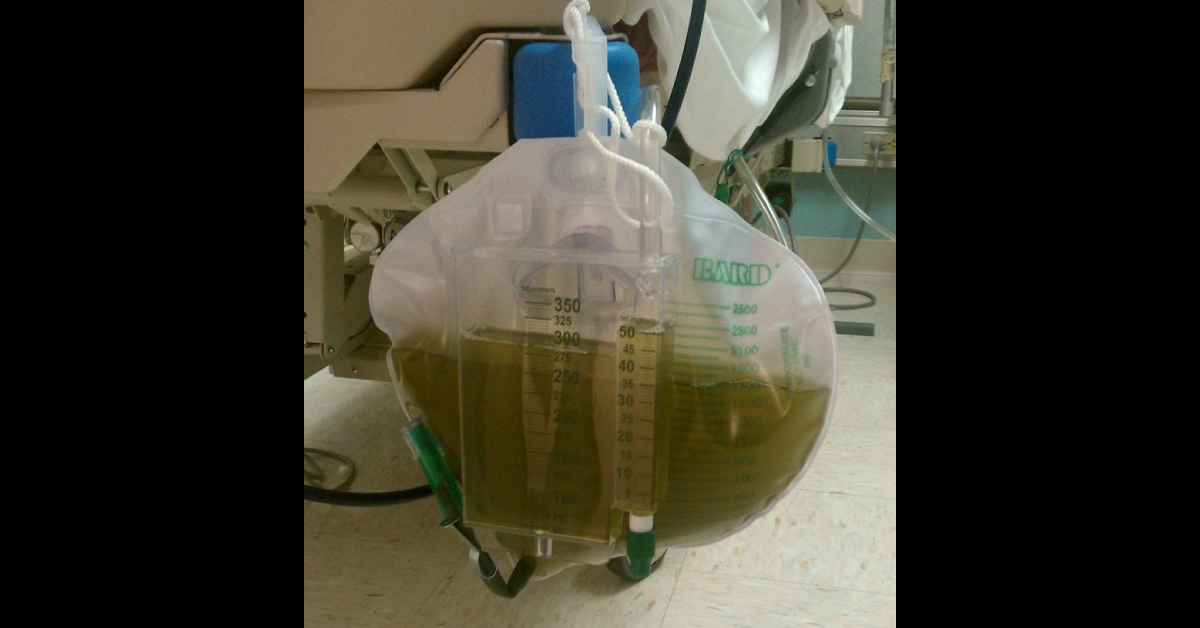 Identify The Reason For Green Urine