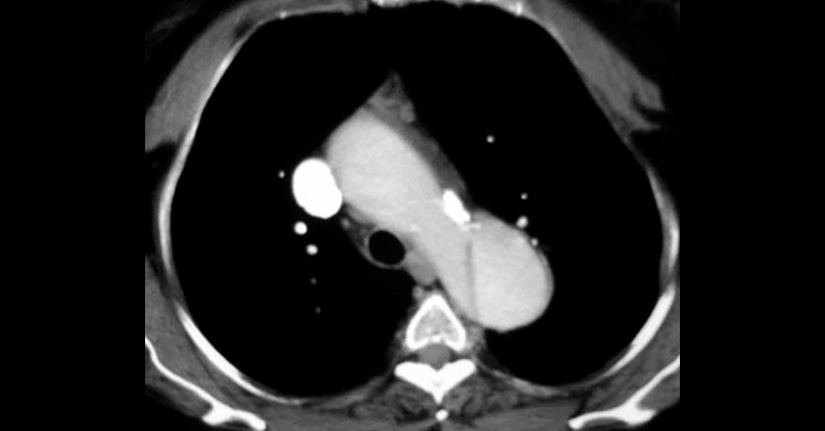 Interpret These Radiologic Findings