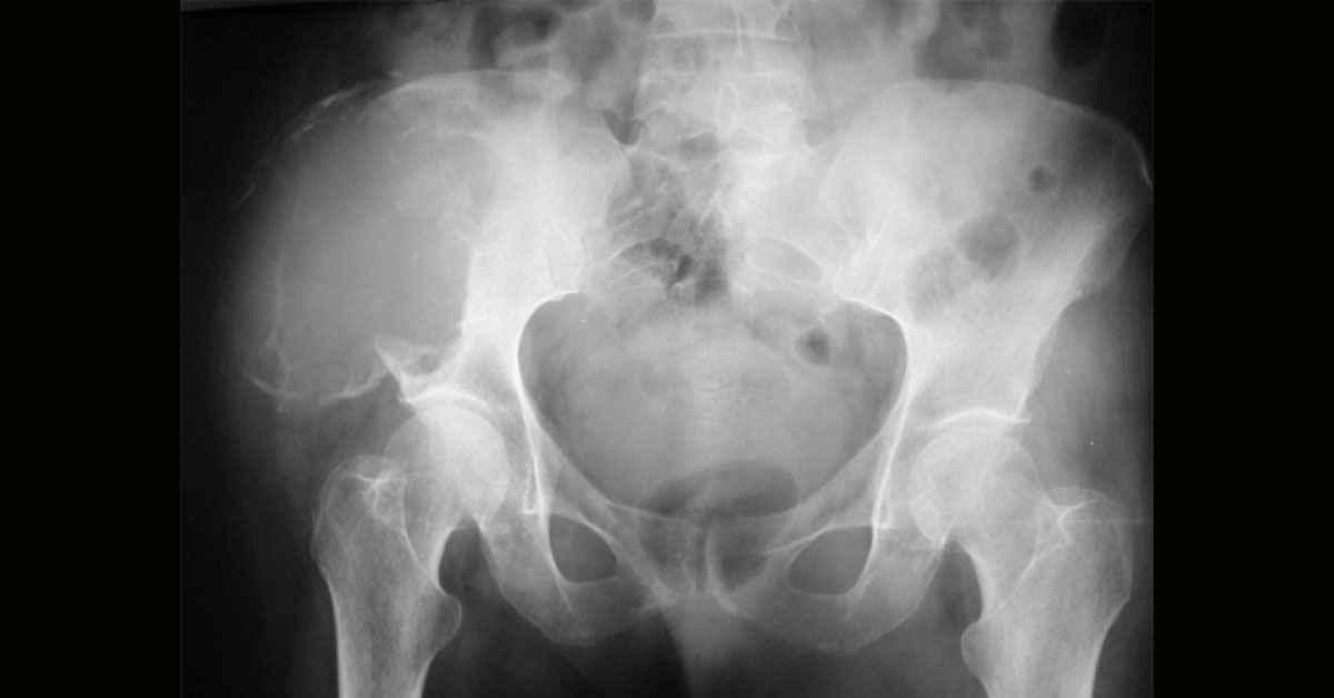 Give Your Diagnosis