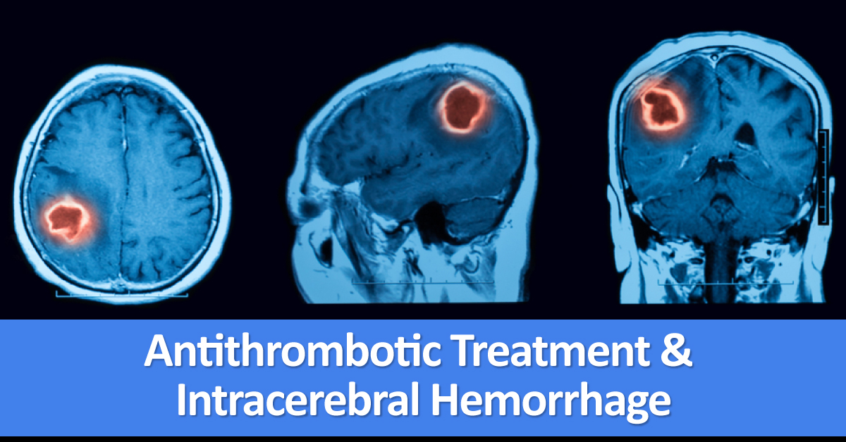 Antithrombotic Treatment After Intracerebral Hemorrhage