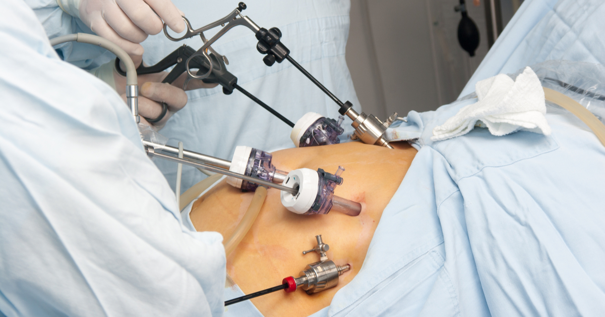 Government Should Encourage Mini Bypass Surgery For Diabetes Cure
