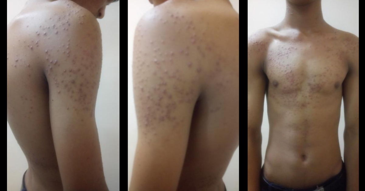 Identify This Skin Condition
