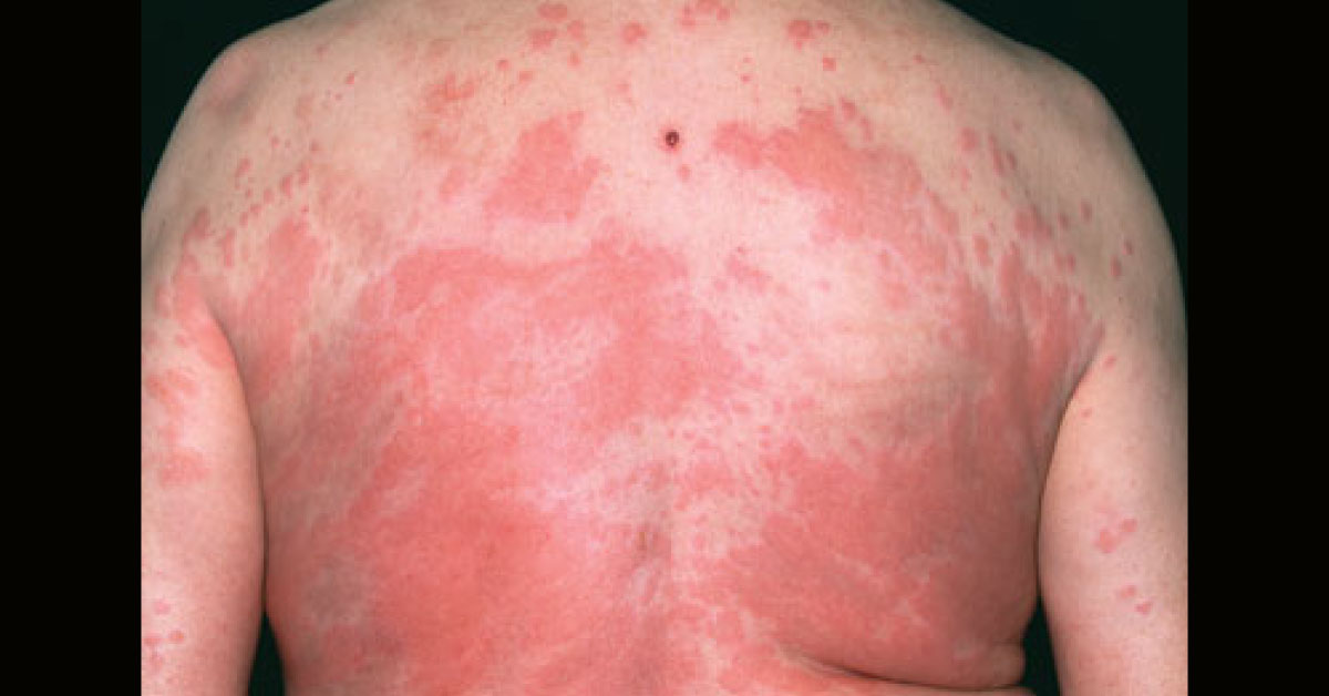 Identify The Condition