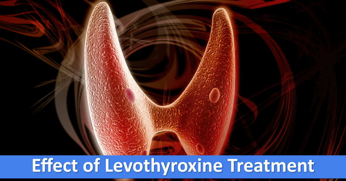 Levothyroxine Treatment For Subclinical Hypothyroidism