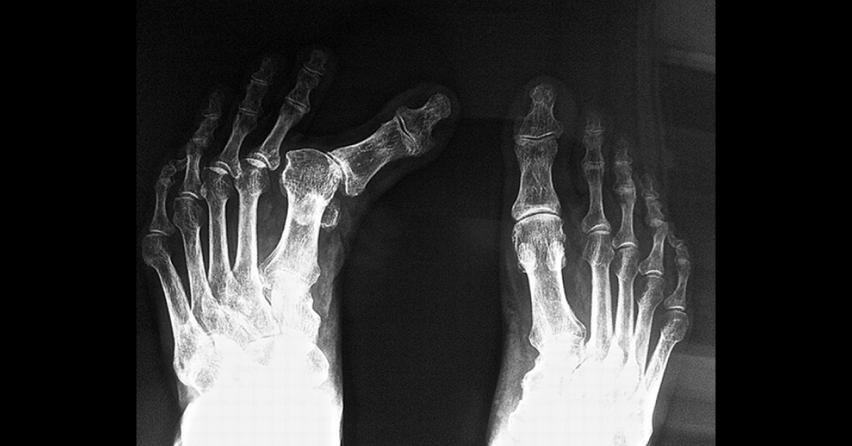 Identify This Defect From The Radiograph
