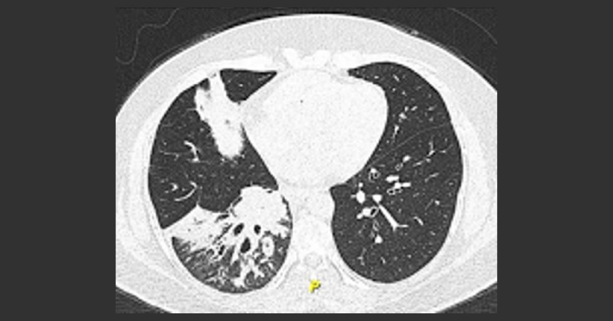 Treat The Patient And Not An Investigation Report