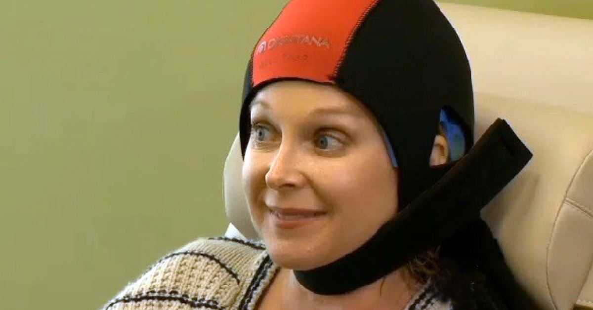 Scalp Hypothermia To Prevent Chemotherapy Induced Alopecia