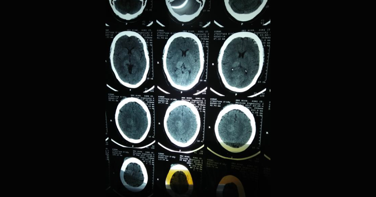 Diagnose from CT Scan Of Head