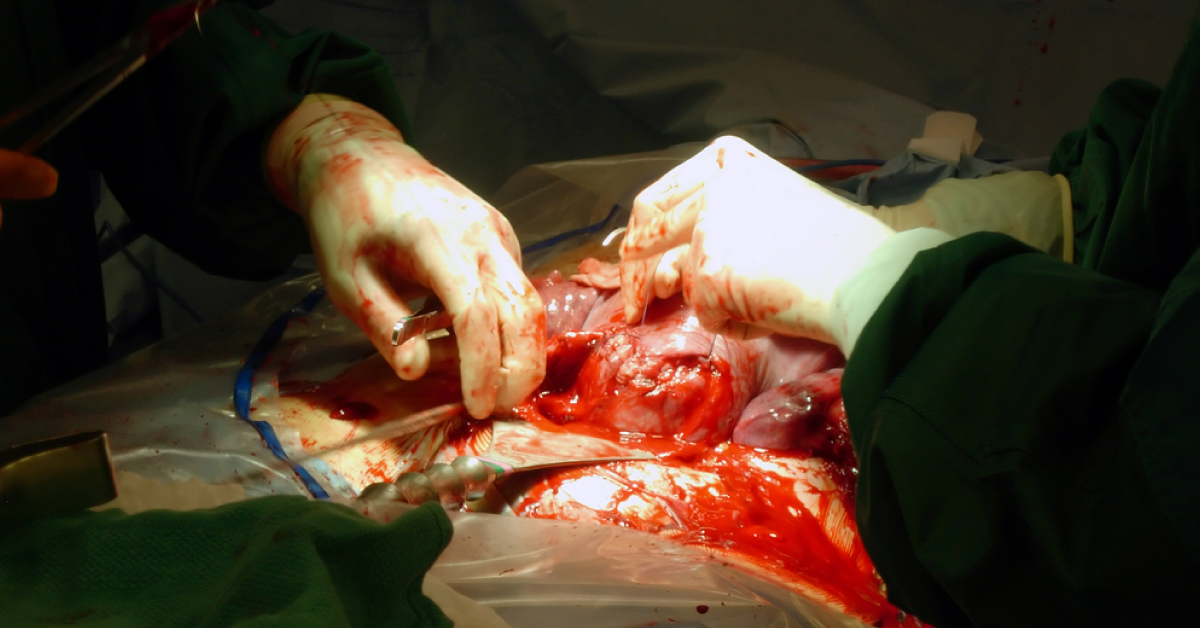 Tranexamic Acid And Postpartum Haemorrhage