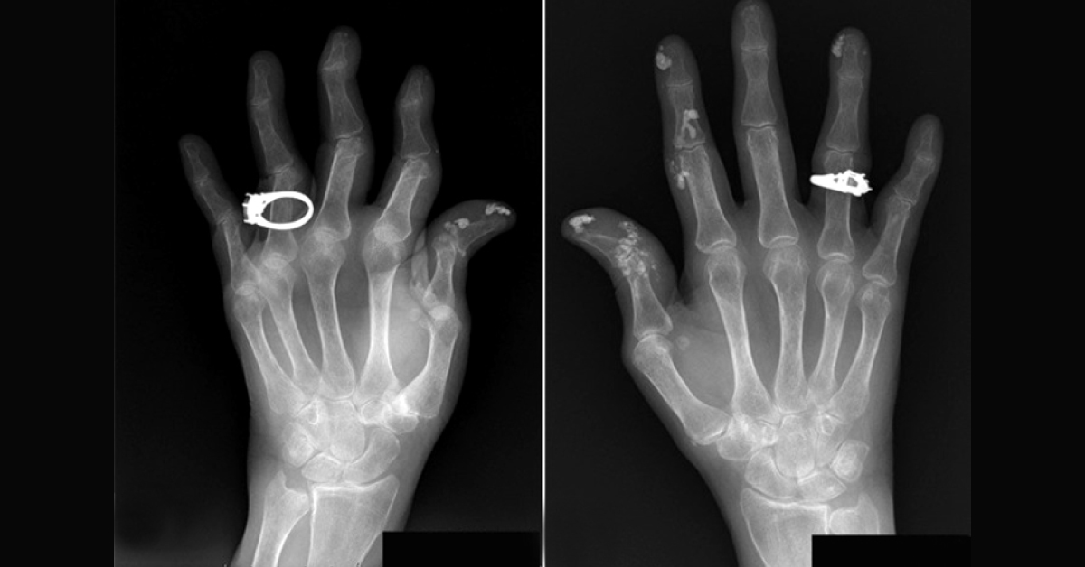 Diagnose From Radiograph