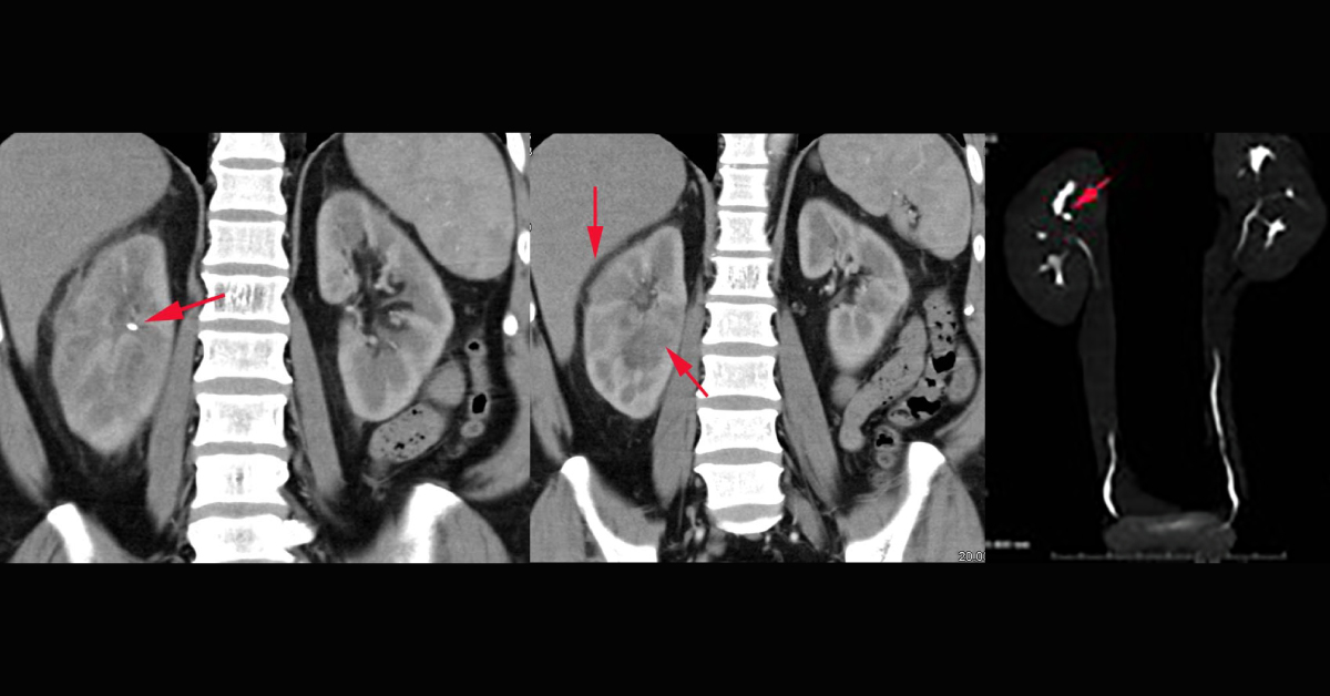 Nephrology, Spot Diagnosis
