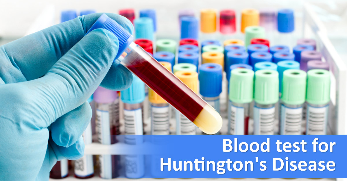 Now Blood Test To Track And Predict Huntingtons