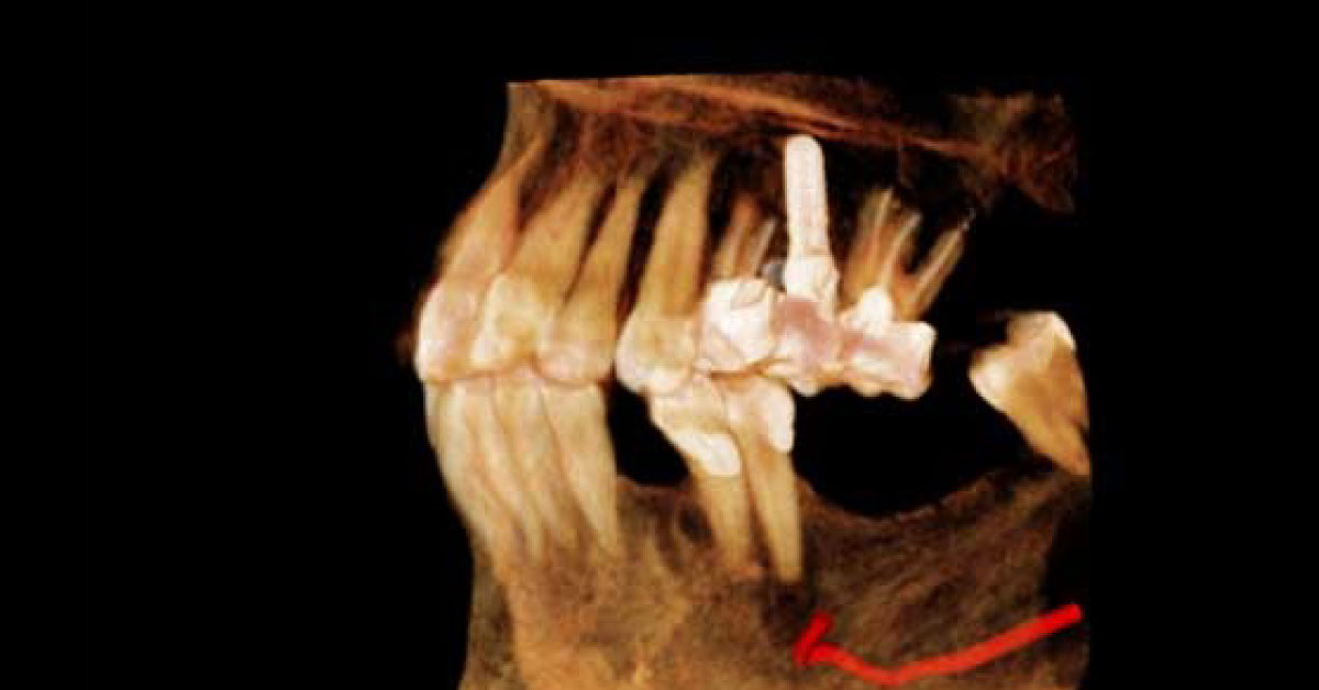 Diagnose This Dental Lesion