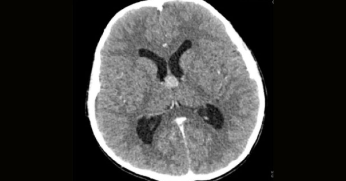 Interpret The Radiological Findings