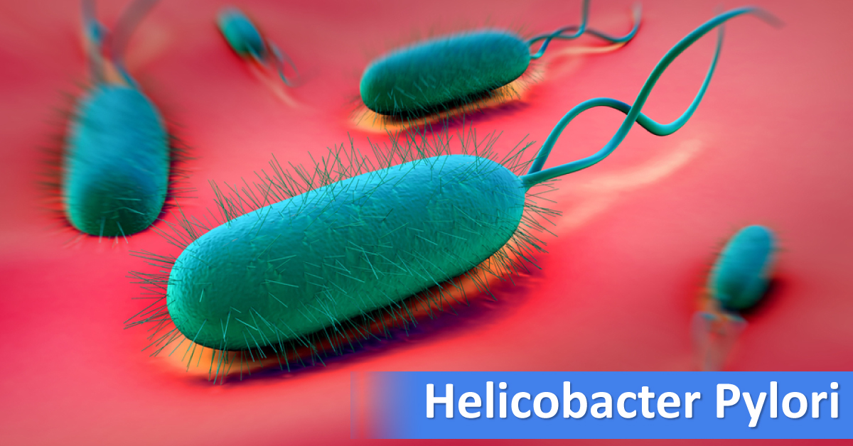 H Pylori Infused Oxidative Stress Accelerates Gastric Cancer