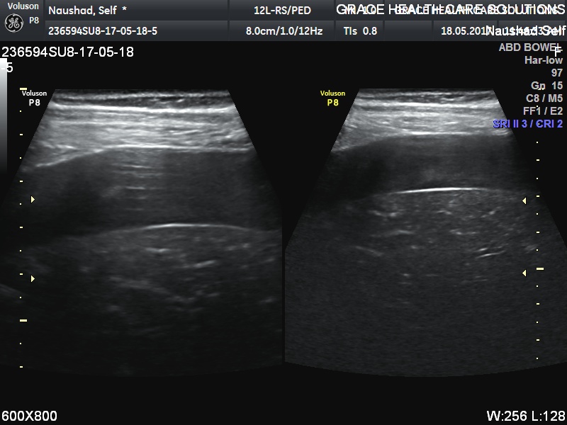 Diagnose Intense Pain In Abdomen