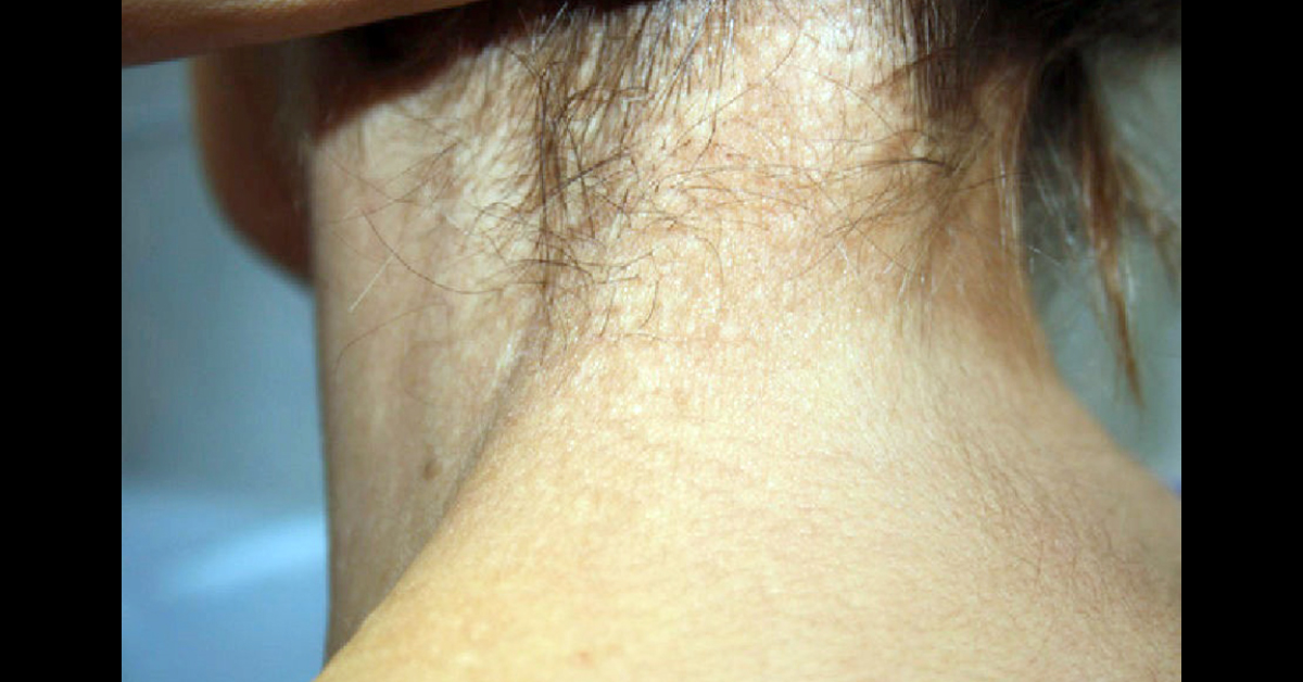 Identify This Dermatology Condition
