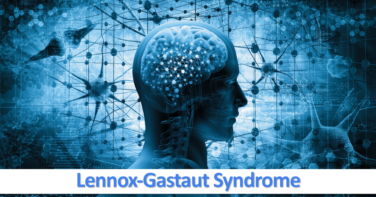 Lennox Gastaut Syndrome, Management And Therapeutic Options