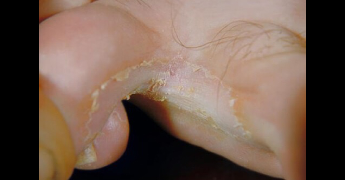 Dermatology, Spot Diagnosis