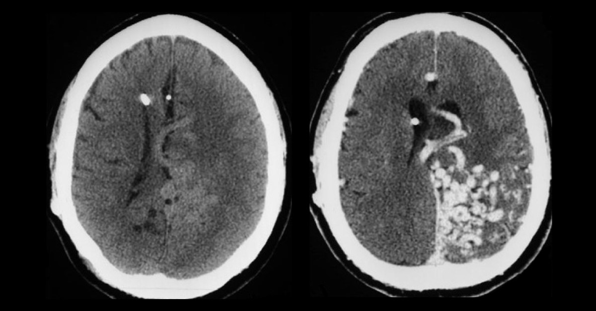 Spot The Condition From Radiograph