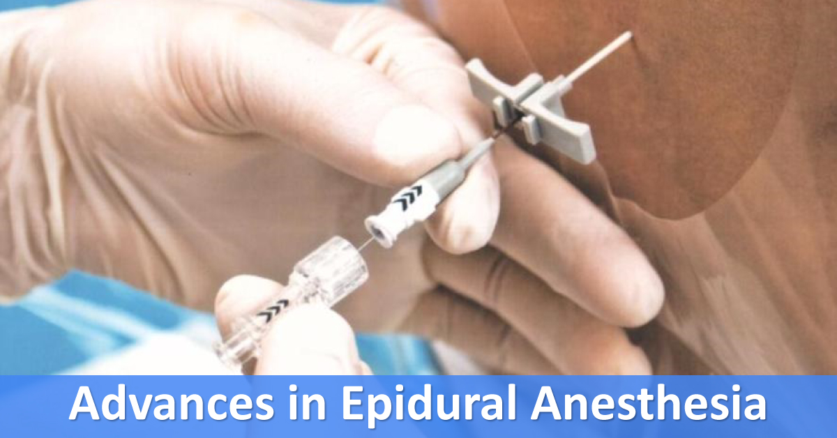 Epidural Anesthesia, An Overview