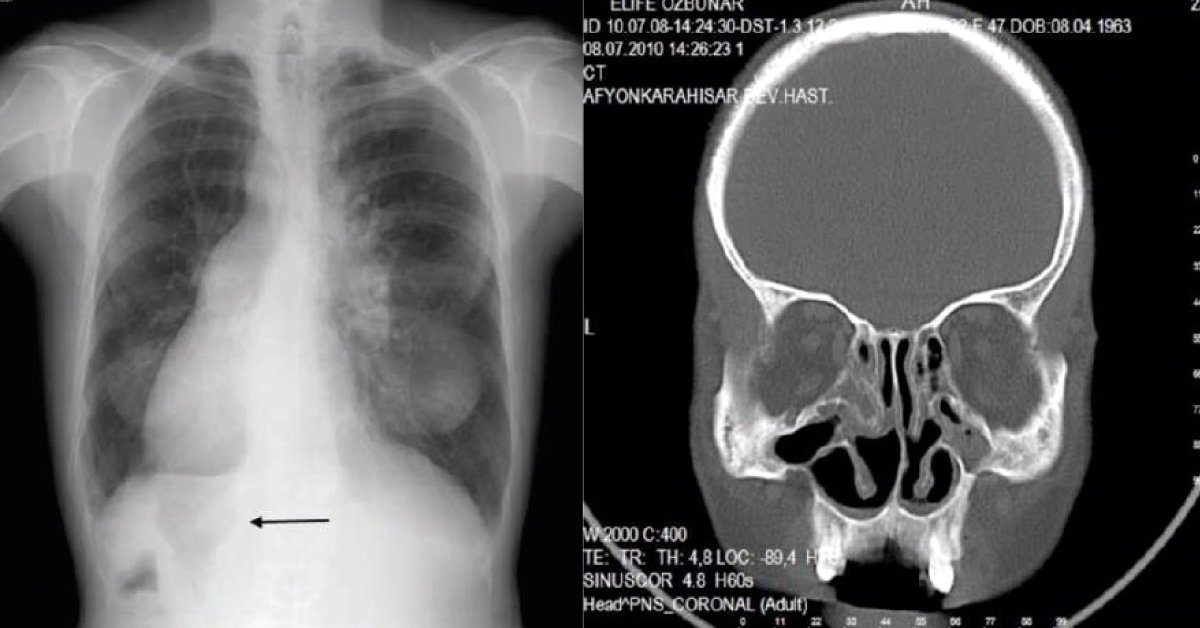 Solve The Case Of Misdiagnosed Asthma