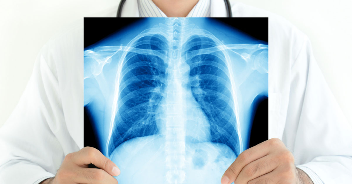 Advances In Radiology That Empowered Healthcare Sector