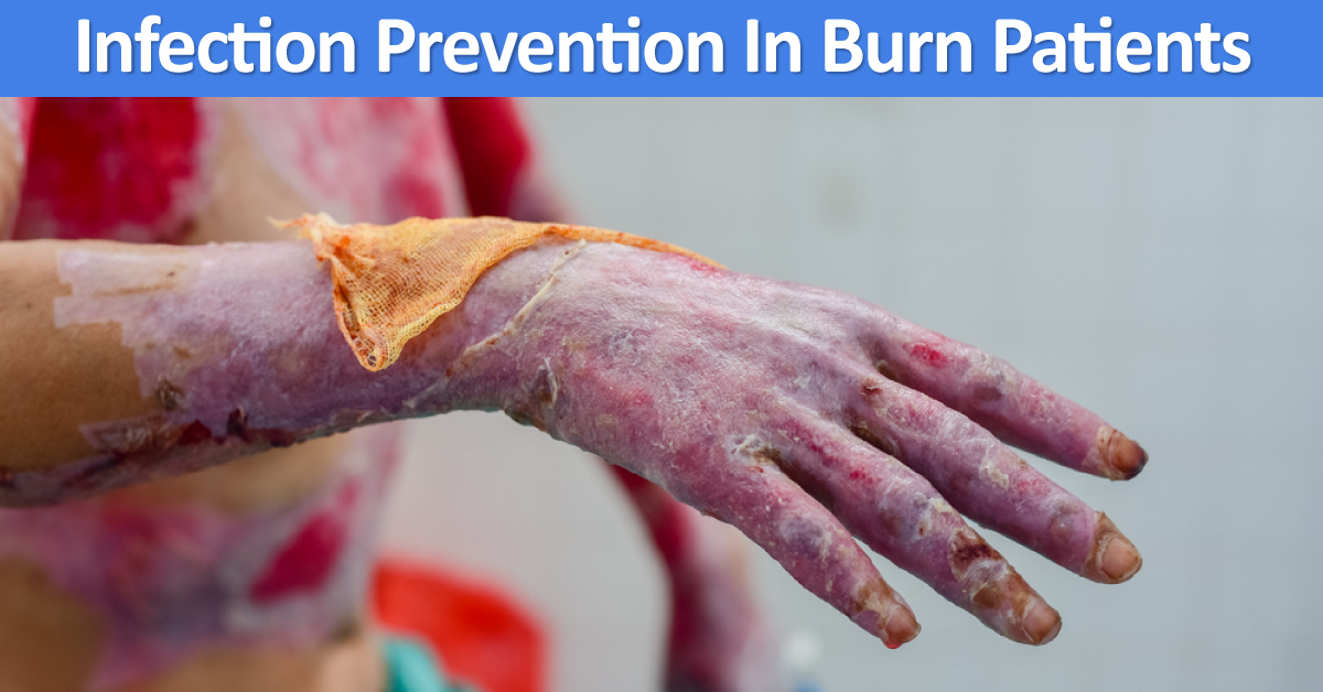 Infection Management In Burn Patients