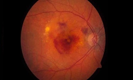 What is your diagnosis?