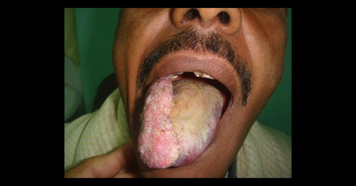 Identify The Condition