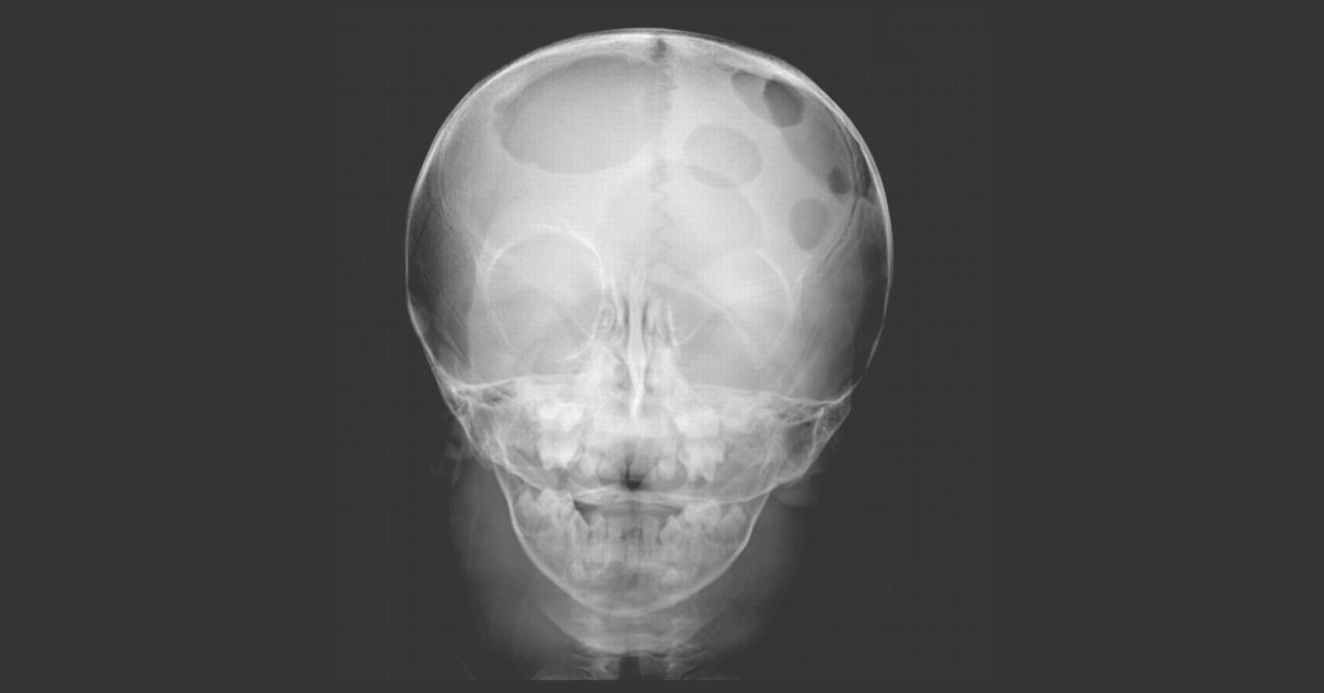 Identify This Condition In A Two Year Old Boy