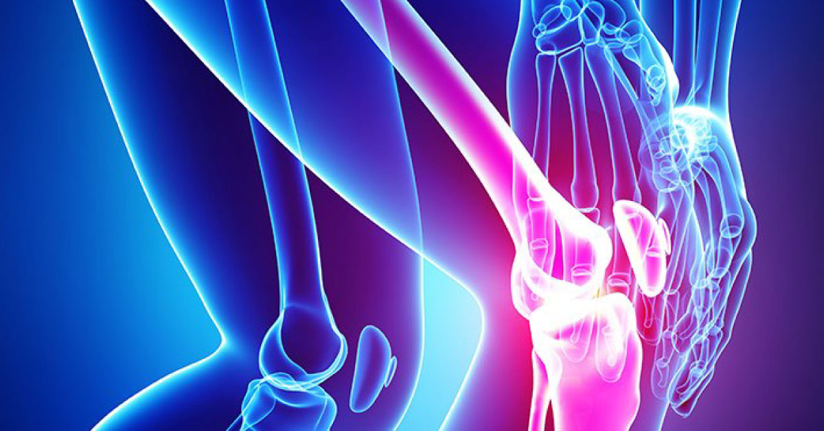 Preventing Osteoarthritis: Latest Research On Good Joint Health
