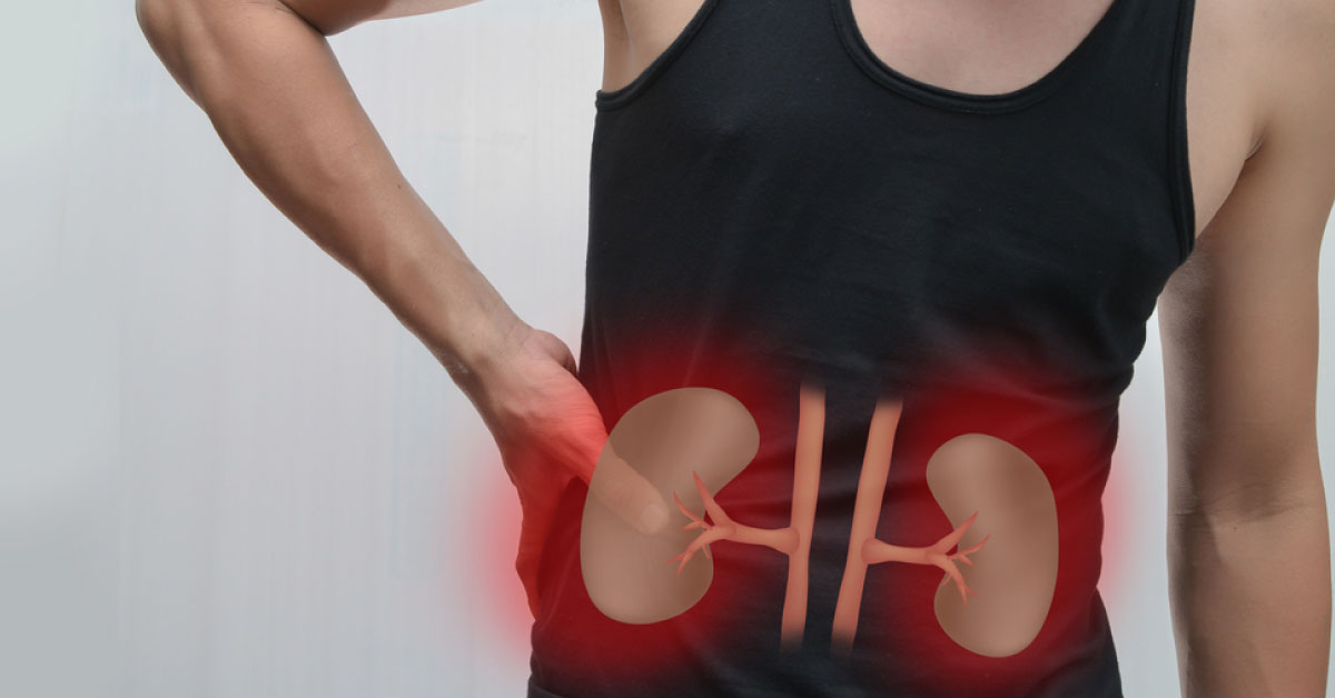 Prospects in Treating Lupus Nephritis