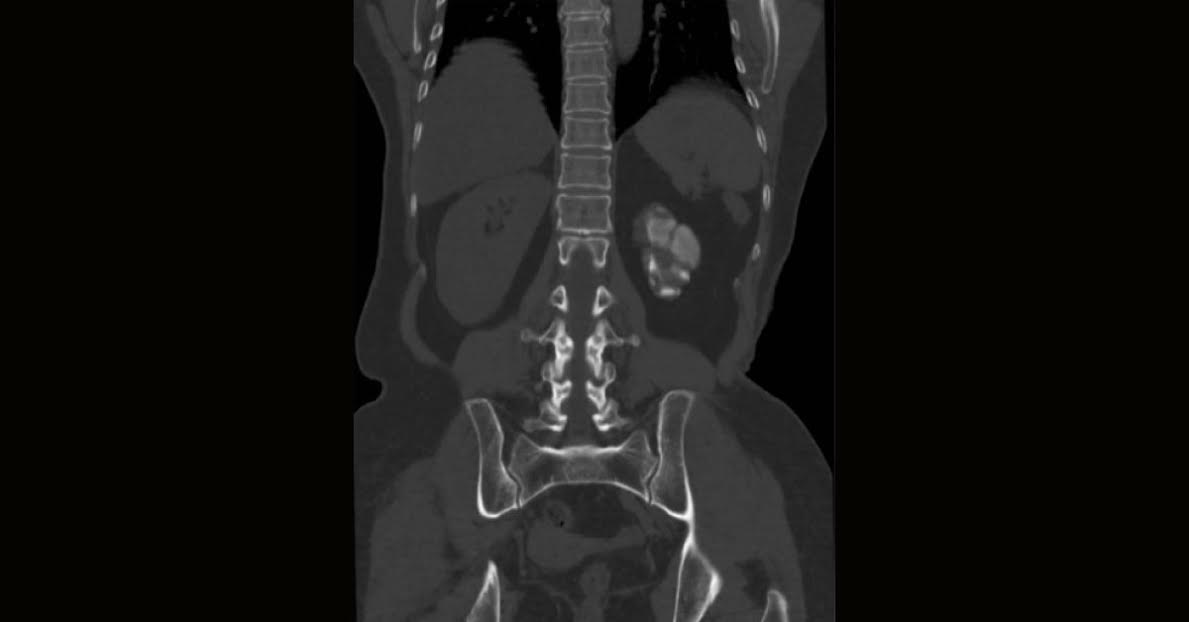 Spot The Diagnosis
