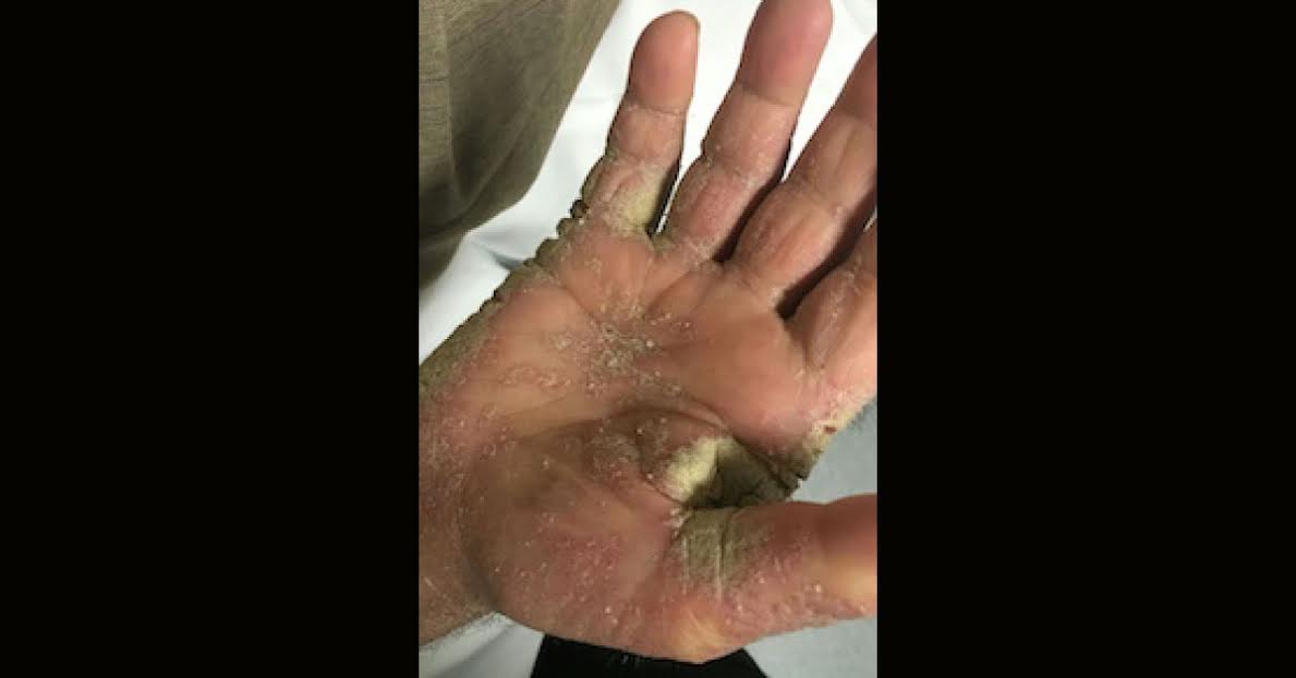 Identify The Medical Condition
