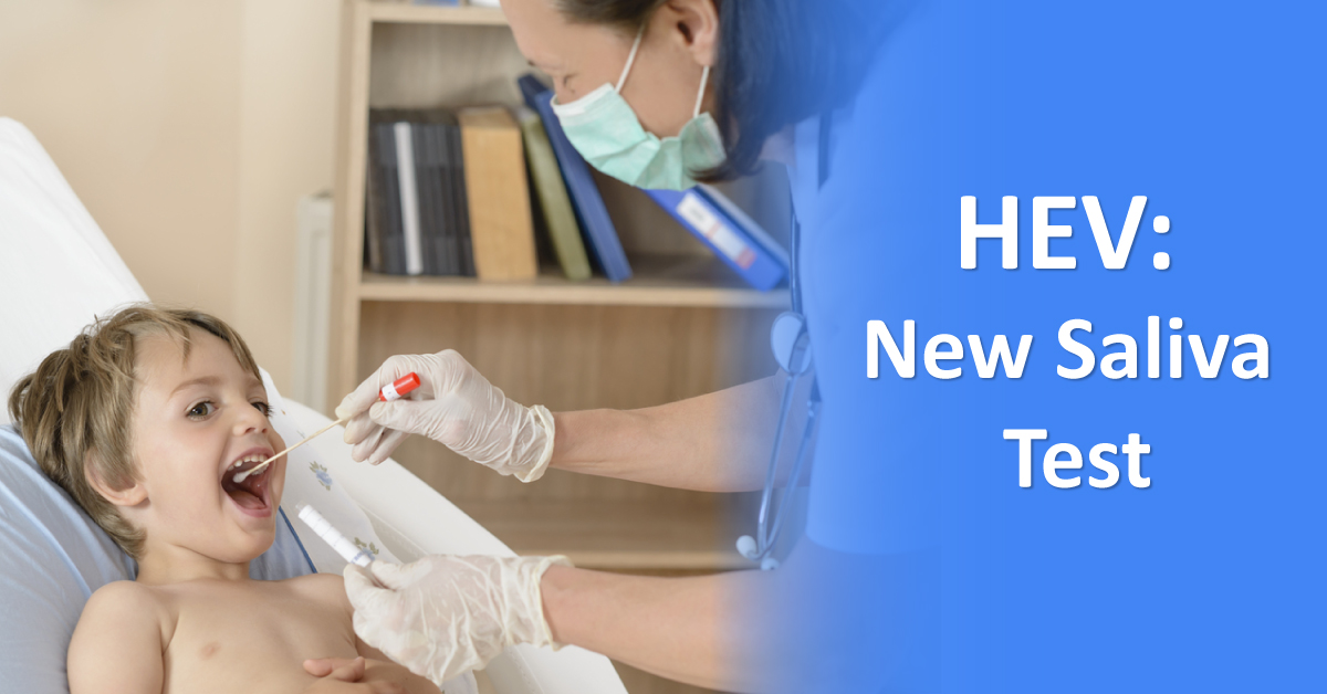 Alternative Test For Hepatitis E Infection, Will You Recommend It?