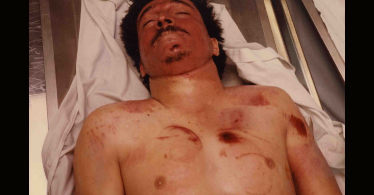 Identify The Cause Of Death