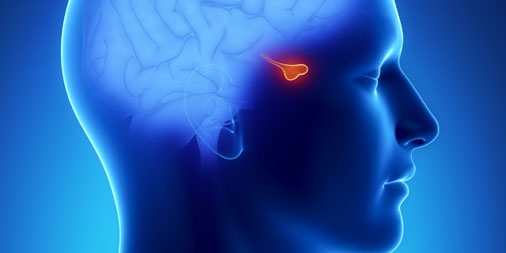 Which Of The Conditions Is Related To Pituitary Tumor?