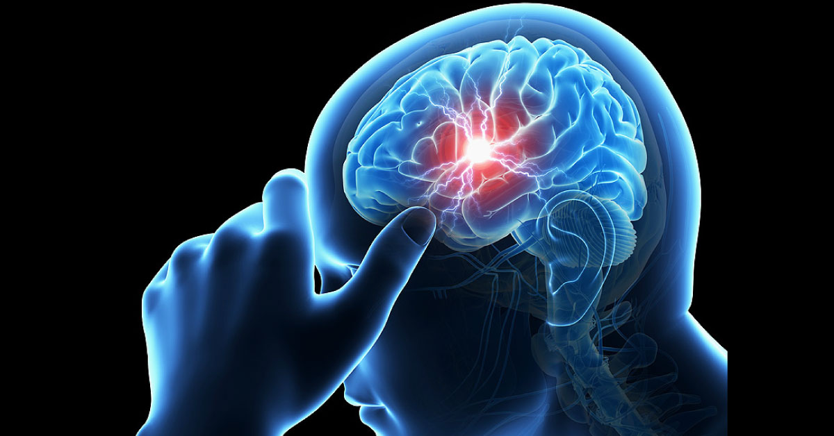 Preventive Strategies For Cardioembolic Stroke