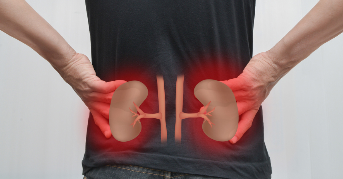 Acute Kidney Injury Management Guidelines