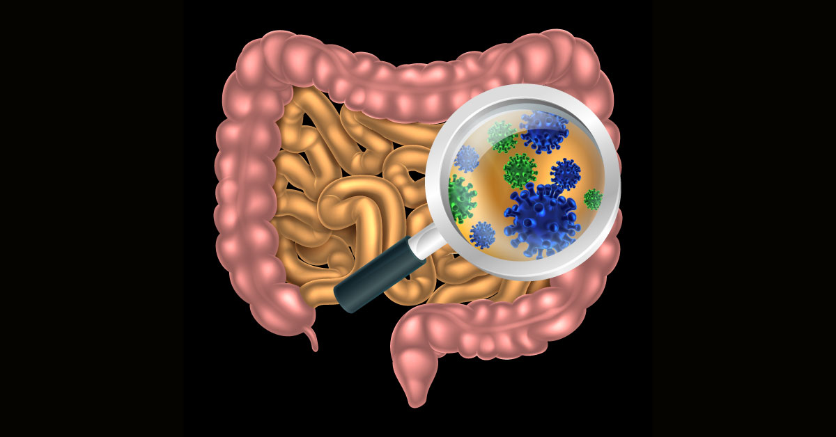 Fecal Microbiota Transplantation