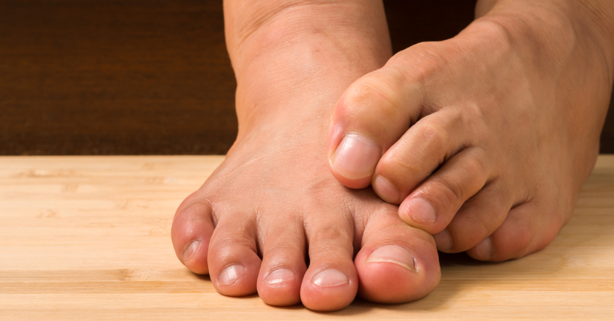 Stimulating Big Toes Reduce Urinary Symptoms