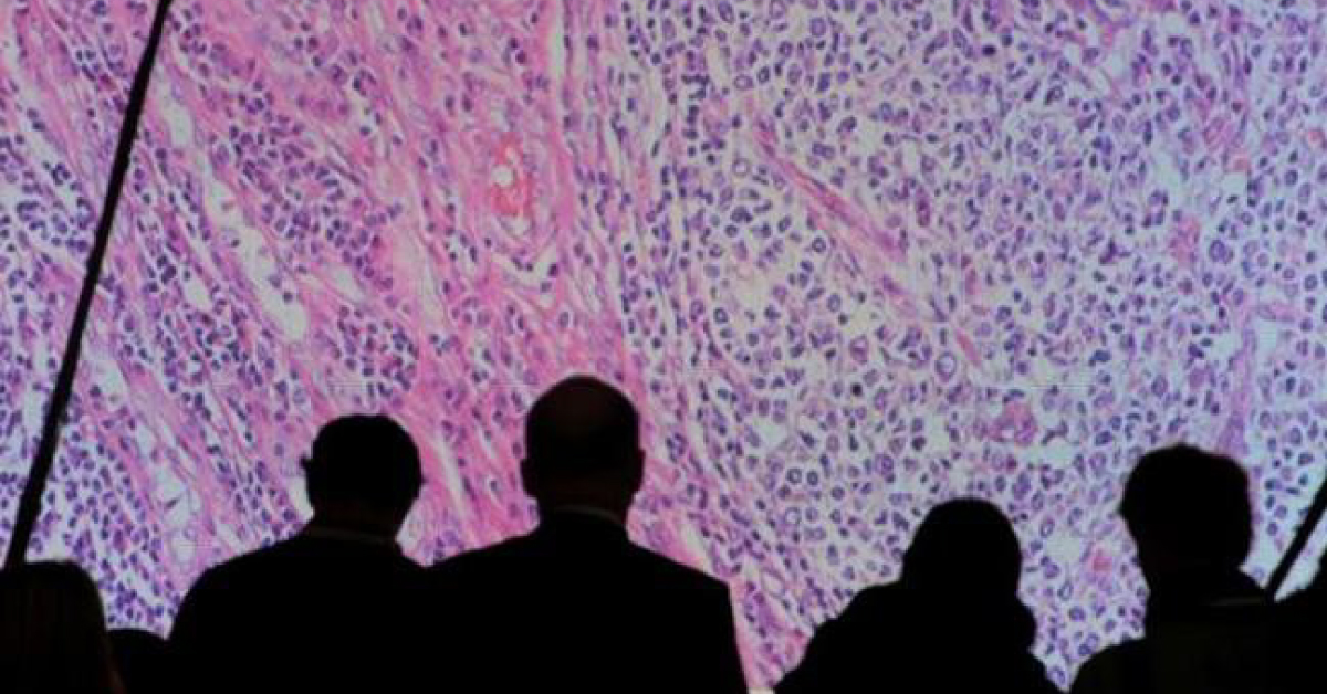 A Nuclear Medicine Against Neruo Endocrino Gastro Pancreatic Tumors Approved Which Killed Job Steve