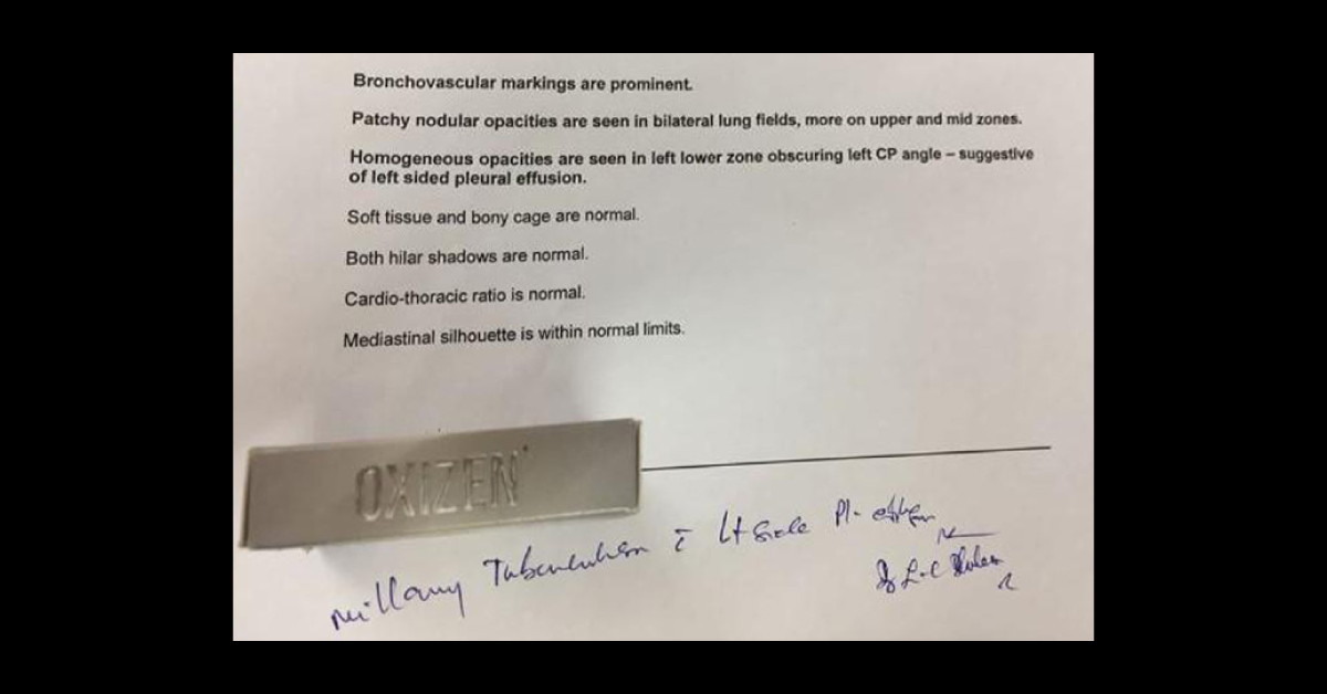 Is This Milliary TB Or Fungal Infection?