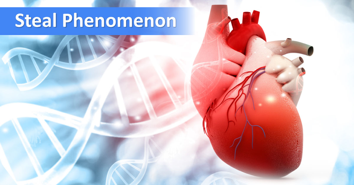 Steal Phenomenon In Myocardium